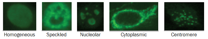 examples of the different patterns of cells